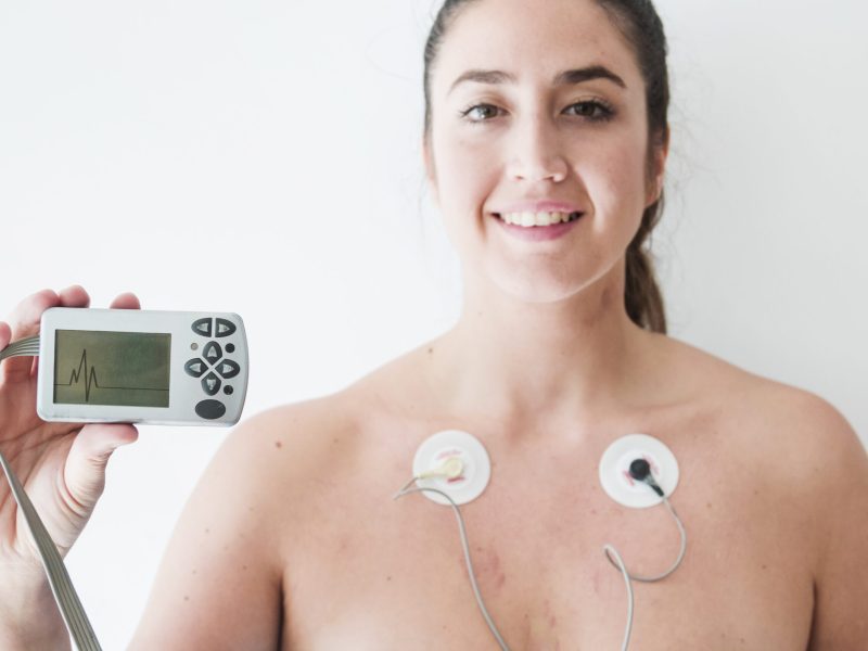 lady-with-electrodes-holding-monitor-with-cardiogram