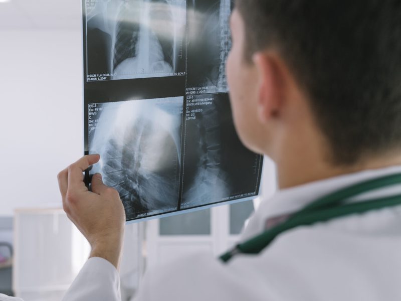 medic-standing-with-x-ray-shot